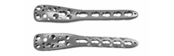 Проксимальна плечева мищелкова блокуюча пластина UMP